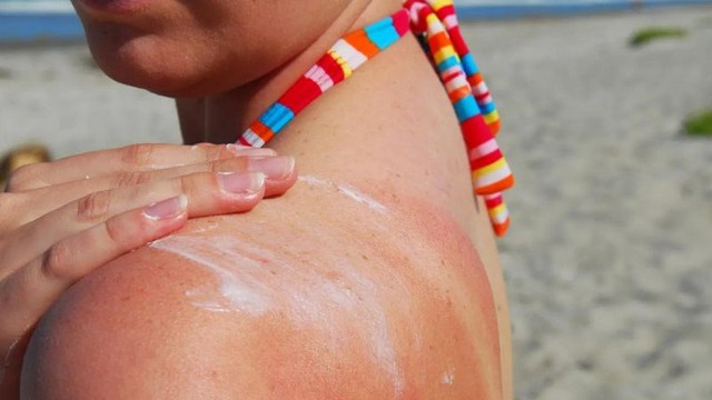 Tác hại của việc không dùng kem chống nắng - Ảnh 1. Tác hại của việc không dùng kem chống nắng - Ảnh 1.