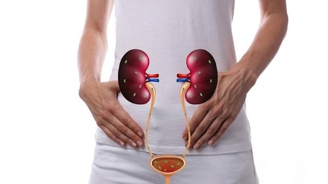 Người phụ nữ 62 tuổi ở Nghệ An bị suy thận vì mắc sai lầm này khi bị viêm đường tiết niệu - Ảnh 1. Người phụ nữ 62 tuổi ở Nghệ An bị suy thận vì mắc sai lầm này khi bị viêm đường tiết niệu - Ảnh 1.