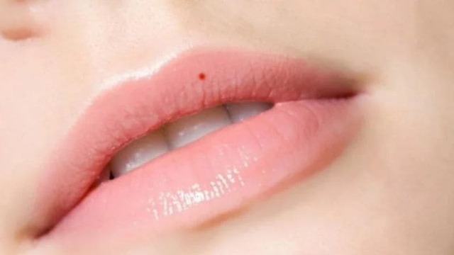 Phụ nữ có nốt ruồi ở vị trí hiếm này: Cả đời hưởng vinh hoa phú quý - Ảnh 1. Phụ nữ có nốt ruồi ở vị trí hiếm này: Cả đời hưởng vinh hoa phú quý - Ảnh 1.