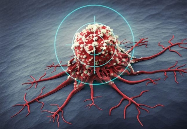 Tế bào ung thư sợ gì nhất? Giải pháp tăng cường hệ miễn dịch ngăn ngừa tế bào ung thư? - Ảnh 2. Tế bào ung thư sợ gì nhất? Giải pháp tăng cường hệ miễn dịch ngăn ngừa tế bào ung thư? - Ảnh 2.