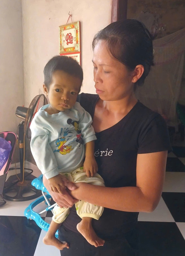 C&ugrave;ng V&ograve;ng tay nh&acirc;n &aacute;i gi&uacute;p b&eacute; C&ocirc;ng c&oacute; cơ hội sống mới từ gh&eacute;p gan - Ảnh 3.