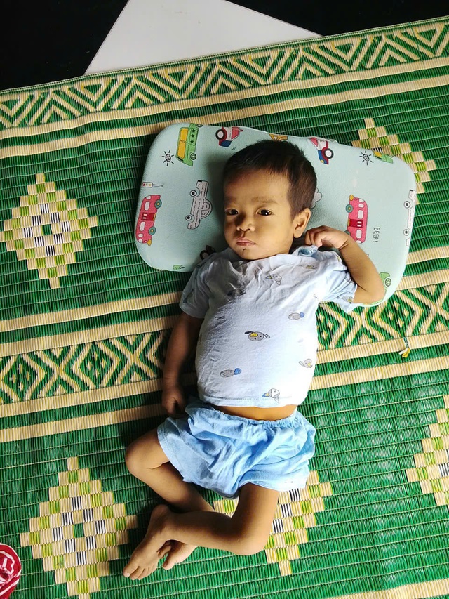 C&ugrave;ng V&ograve;ng tay nh&acirc;n &aacute;i gi&uacute;p b&eacute; C&ocirc;ng c&oacute; cơ hội sống mới từ gh&eacute;p gan - Ảnh 2.