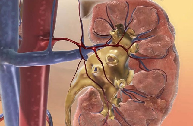 7 dấu hiệu suy thận giai đoạn đầu dễ nhận biết nhưng người Việt thường bỏ qua - Ảnh 2.