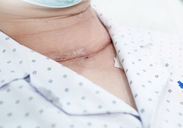 Phi công đang khỏe mạnh bất ngờ phát hiện ung thư tuyến giáp: Bác sĩ khuyên nên làm điều này để ngừa ung thư tái phát - Ảnh 1.