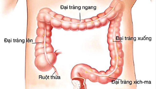 Người mẫu Xuân Mai qua đời ở tuổi 29, căn bệnh cô mắc nguy hiểm thế nào? - Ảnh 3.