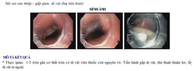 Người đàn ông ở Ninh Bình nhập viện gấp do bất cẩn khi uống thuốc - Ảnh 2.