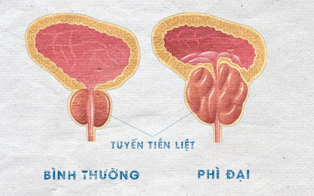 phi-dai-tien-liet-tuyen-17423584180321049876428.jpg