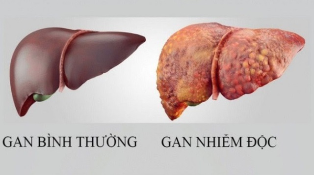Loại quả mùa hè rẻ tiền, ngọt mát giúp làm mát gan, người Việt dùng vào thời điểm này để giúp gan thải độc - Ảnh 3. Loại quả mùa hè rẻ tiền, ngọt mát giúp làm mát gan, người Việt dùng vào thời điểm này để giúp gan thải độc - Ảnh 3.