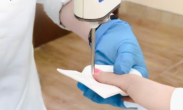 Đau ở ngón tay, bé 13 tuổi bất ngờ phát hiện bị u cuộn mạch, bác sĩ chỉ rõ có dấu hiệu này cần khám sớm - Ảnh 3.