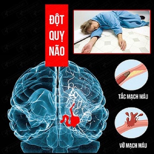 dot-quy-nao-1749963827043233098947.jpg