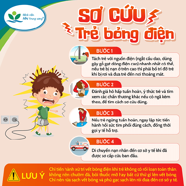 so-cuu-tre-bi-bong-dien4-17500669213771681801204.png