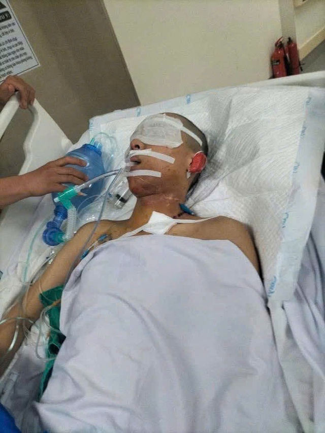 MS 1014: Sự sống mong manh của nam sinh lớp 12 bị sét đánh nguy kịch khi đi phụ mẹ ngoài đồng - Ảnh 2. MS 1014: Sự sống mong manh của nam sinh lớp 12 bị sét đánh nguy kịch khi đi phụ mẹ ngoài đồng - Ảnh 2.