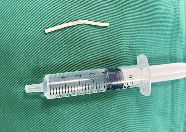 que-tranh-thai-17510726855721176669072.jpg
