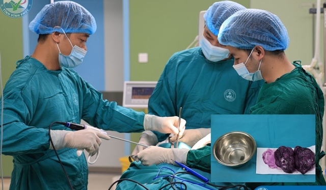 Người phụ nữ 28 may mắn tránh được nguy cơ biến chứng u tuyến giáp kích thước lớn - Ảnh 2. Người phụ nữ 28 may mắn tránh được nguy cơ biến chứng u tuyến giáp kích thước lớn - Ảnh 2.