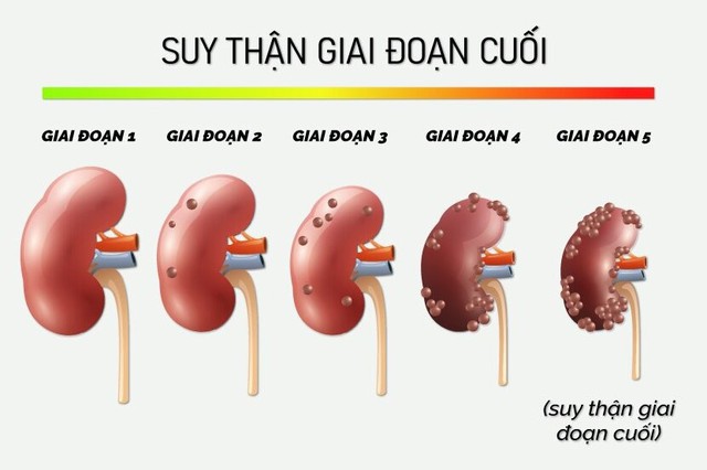 suy-than-1749201506654364525736.jpg