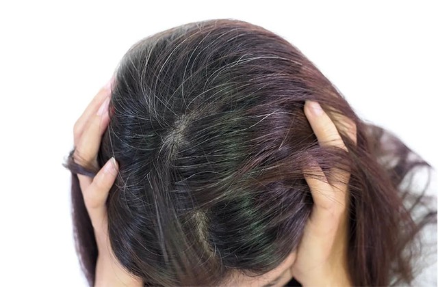 Tóc bạc sớm muốn đen, đẹp mà không dùng thuốc nhuộm, hãy sử dụng ngay phương pháp này - Ảnh 2.