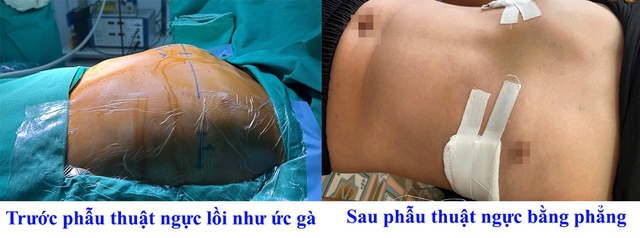 Bé 12 tuổi chia sẻ nguyên nhân mặc cảm, tự ti, ngại giao tiếp: Đây là lý do chính! - Ảnh 2. Bé 12 tuổi chia sẻ nguyên nhân mặc cảm, tự ti, ngại giao tiếp: Đây là lý do chính! - Ảnh 2.
