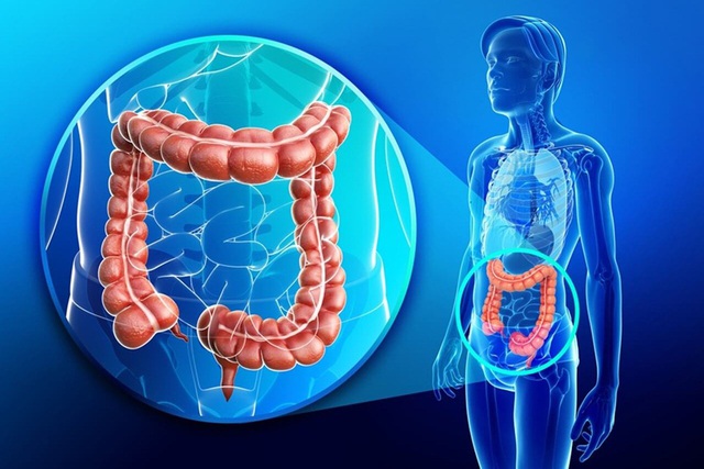 Dấu hiệu nhận biết ung thư trực tràng: Người trong gia đình có dấu hiệu này cần cảnh giác- Ảnh 2. Dấu hiệu nhận biết ung thư trực tràng: Người trong gia đình có dấu hiệu này cần cảnh giác- Ảnh 2.
