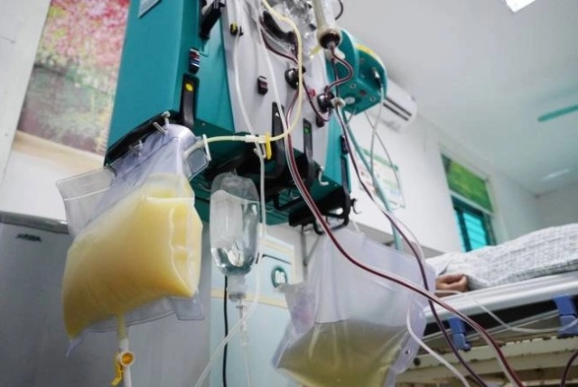 Người đàn ông 34 tuổi máu đục như sữa vì viêm tụy cấp thừa nhận 2 thói quen cần từ bỏ sớm - Ảnh 2. Người đàn ông 34 tuổi máu đục như sữa vì viêm tụy cấp thừa nhận 2 thói quen cần từ bỏ sớm - Ảnh 2.
