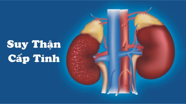 Suy thận cấp có chữa khỏi được không? 3 nhóm người có nguy cơ cao, cần cảnh giác!- Ảnh 2. Suy thận cấp có chữa khỏi được không? 3 nhóm người có nguy cơ cao, cần cảnh giác!- Ảnh 2.