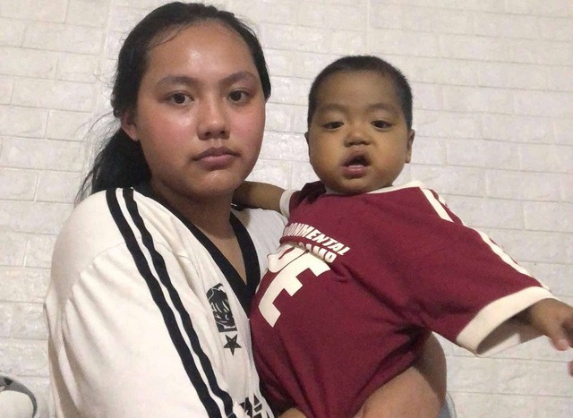 MS 1018: Sự sống mong manh của bé trai 21 tháng tuổi bị teo mật bẩm sinh, xơ gan - Ảnh 3. MS 1018: Sự sống mong manh của bé trai 21 tháng tuổi bị teo mật bẩm sinh, xơ gan - Ảnh 3.