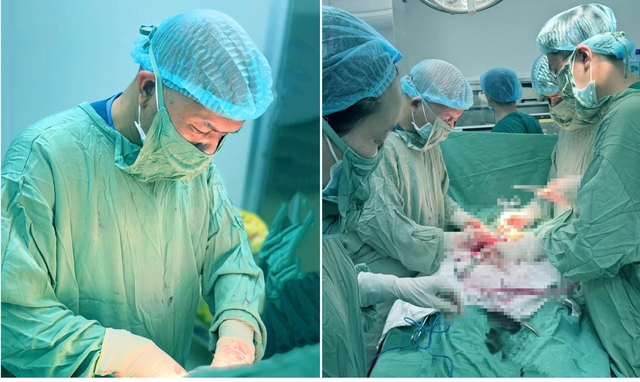 Nghẹt thở hành trình vừa giữ con vừa bảo toàn tính mạng cho sản phụ mắc ung thư cổ tử cung - Ảnh 1.