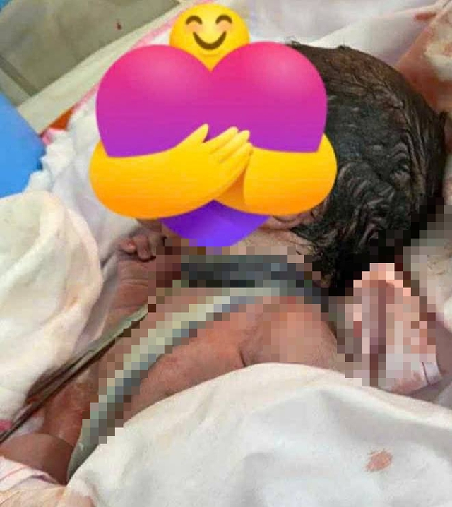 Bé trai chào đời với 6 vòng dây rốn quấn cổ: Điều mẹ bầu nên biết khi thai nhi bị dây rốn quấn cổ - Ảnh 1. Bé trai chào đời với 6 vòng dây rốn quấn cổ: Điều mẹ bầu nên biết khi thai nhi bị dây rốn quấn cổ - Ảnh 1.