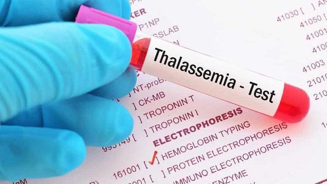 Trăn trở đẩy lùi nỗi đau Thalassemia- Ảnh 1. Trăn trở đẩy lùi nỗi đau Thalassemia- Ảnh 1.