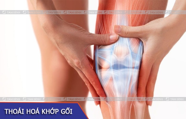 thoai-hoa-khop-goi-01-1754369354063-17543693562621026427330.jpg