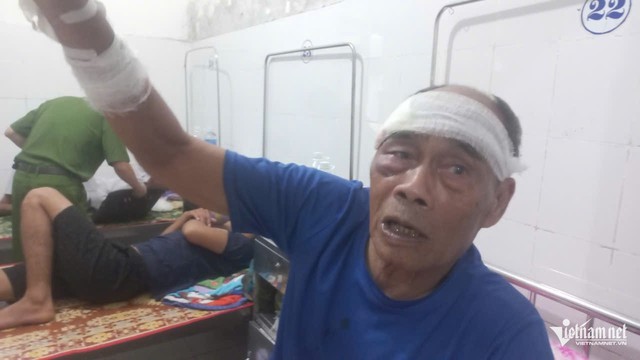 Lời kể của nạn nhân sống sót vụ xe tải đâm vào chợ chuối khiến 12 người thương vong ở Quảng Trị - Ảnh 1. Lời kể của nạn nhân sống sót vụ xe tải đâm vào chợ chuối khiến 12 người thương vong ở Quảng Trị - Ảnh 1.
