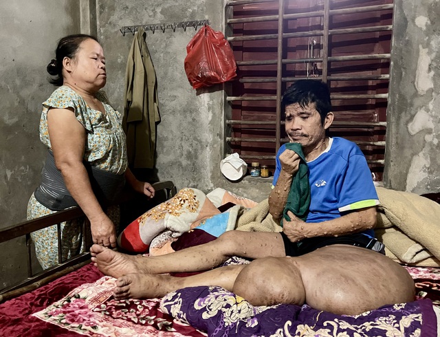 'Cảm ơn những nh&agrave; hảo t&acirc;m mang đến hơi ấm cho chồng t&ocirc;i những ng&agrave;y cuối đời' - Ảnh 3.