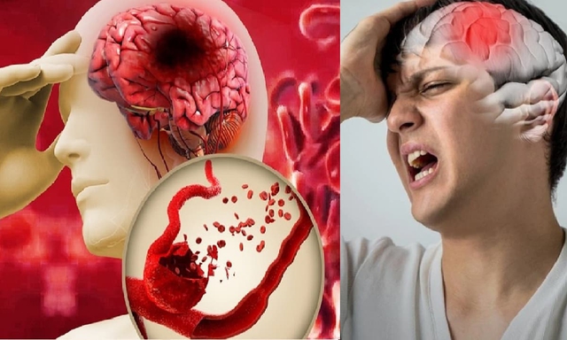 Xuất huyết n&atilde;o thường xảy ra v&agrave;o 10 'thời điểm' nguy hiểm n&agrave;y: Những ai n&ecirc;n đi kh&aacute;m ngay lập tức? - Ảnh 1.