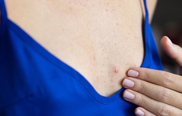 Tế b&agrave;o ung thư h&igrave;nh th&agrave;nh thế n&agrave;o trong cơ thể? Người Việt cần hiểu đ&uacute;ng để ngăn ngừa từ sớm - Ảnh 3.