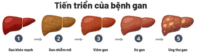 Các loại nước uống thải độc gan không thể thiếu trong nhà, nhất là dịp Tết - Ảnh 1. Các loại nước uống thải độc gan không thể thiếu trong nhà, nhất là dịp Tết - Ảnh 1.