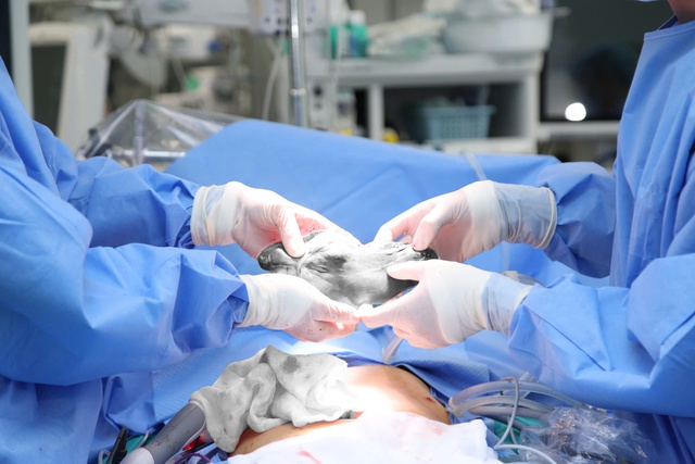 Người phụ nữ 46 tuổi ph&aacute;t hiện u gan k&iacute;ch thước lớn từ dấu hiệu nhiều người Việt mắc phải - Ảnh 1.