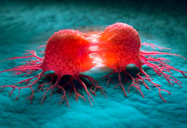 Đặc điểm của tế bào ung thư, người Việt cần hiểu đúng để ngăn ngừa bệnh - Ảnh 2. Đặc điểm của tế bào ung thư, người Việt cần hiểu đúng để ngăn ngừa bệnh - Ảnh 2.