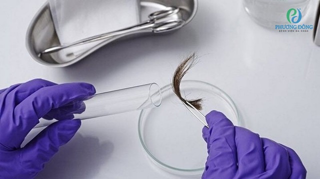 Xét nghiệm ADN khiến chồng nghi vợ ngoại tình, khoa học lại chứng minh người vợ vô tội - Ảnh 1. Xét nghiệm ADN khiến chồng nghi vợ ngoại tình, khoa học lại chứng minh người vợ vô tội - Ảnh 1.