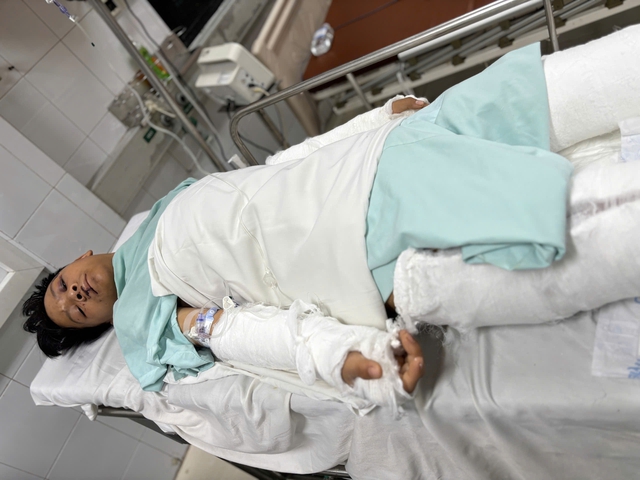 Vòng tay nhân ái cứu giúp em Hoàng Văn Sơn sau tai nạn giao thông - Ảnh 2. Vòng tay nhân ái cứu giúp em Hoàng Văn Sơn sau tai nạn giao thông - Ảnh 2.