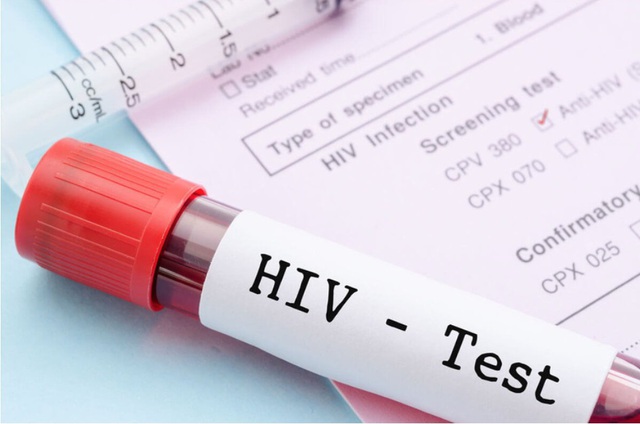 Đi khám vì đau họng, cô gái bất ngờ phát hiện HIV - Ảnh 1. Đi khám vì đau họng, cô gái bất ngờ phát hiện HIV - Ảnh 1.