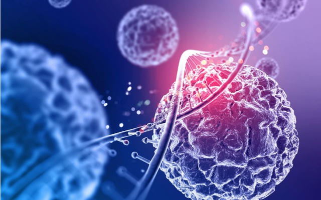 Tế b&agrave;o ung thư 'th&iacute;ch' nhất 5 vị tr&iacute; n&agrave;y tr&ecirc;n cơ thể, người Việt n&ecirc;n biết để ph&ograve;ng ngừa từ sớm - Ảnh 3.