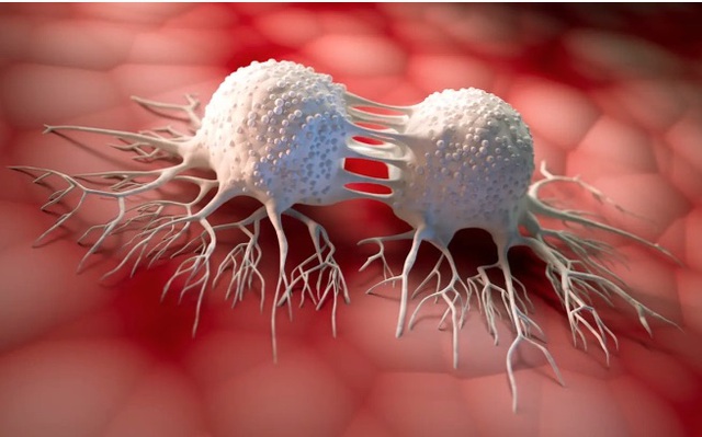 5 vị tr&iacute; tế b&agrave;o ung thư dễ 'đột nhập', người Việt n&ecirc;n hiểu đ&uacute;ng để ngừa bệnh từ sớm - Ảnh 1.