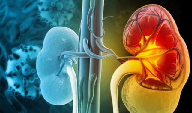 6 nguyên tắc trong ăn uống giúp người bệnh suy thận ngăn ngừa biến chứng - Ảnh 1. 6 nguyên tắc trong ăn uống giúp người bệnh suy thận ngăn ngừa biến chứng - Ảnh 1.