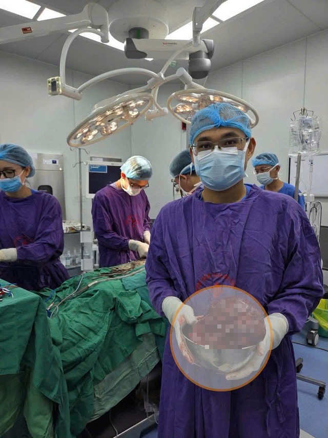 Bụng to dần, sụt c&acirc;n bất thường, người đ&agrave;n &ocirc;ng 43 tuổi ph&aacute;t hiện khối u thận nặng 2 kg - Ảnh 3.