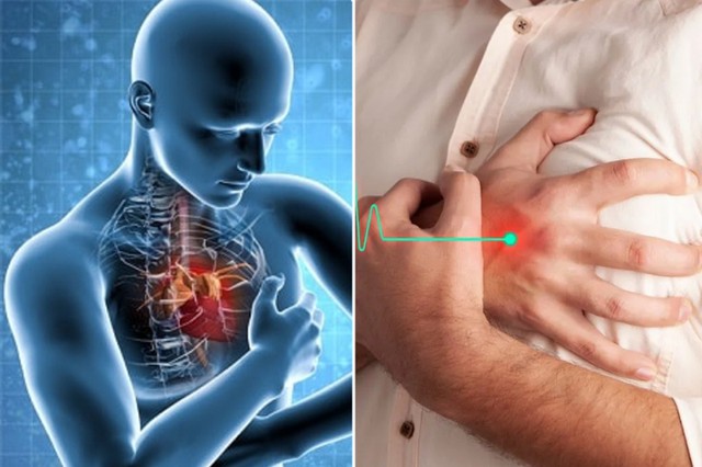 Người đàn ông 56 tuổi nhồi máu cơ tim cấp từ dấu hiệu nhiều người Việt bỏ qua - Ảnh 1.