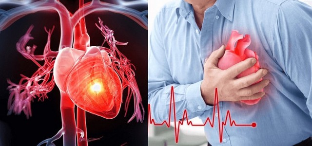 Thời tiết thay đổi, người mắc bệnh tim mạch cần cảnh gi&aacute;c biến chứng nguy hiểm - Ảnh 1.