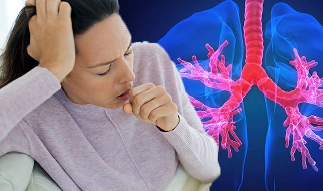 6 nhóm người cần chú ý bệnh hô hấp khi thời tiết thay đổi - Ảnh 3.