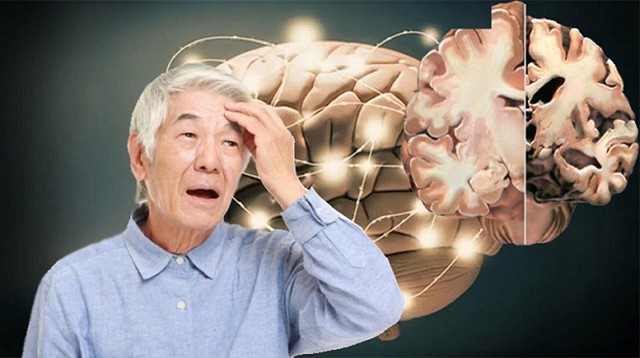 Người cao tuổi cần l&agrave;m g&igrave; để ph&ograve;ng tr&aacute;nh sa s&uacute;t tr&iacute; tuệ? - Ảnh 2.