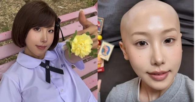 Xu Ziting v&agrave; c&uacute; sốc ung thư dạ d&agrave;y ở người trẻ: Th&oacute;i quen sống nguy hiểm cần tr&aacute;nh - Ảnh 1.