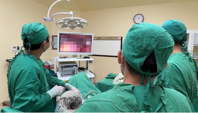 Đau bụng k&eacute;o d&agrave;i, người phụ nữ 63 tuổi đi kh&aacute;m ph&aacute;t hiện dị vật quen thuộc trong bữa cơm - Ảnh 1.