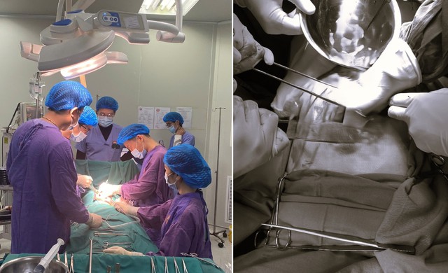 Người đ&agrave;n &ocirc;ng 49 nguy kịch do ng&atilde; từ độ cao 4m khi dọn nh&agrave; đ&oacute;n Tết - Ảnh 1.